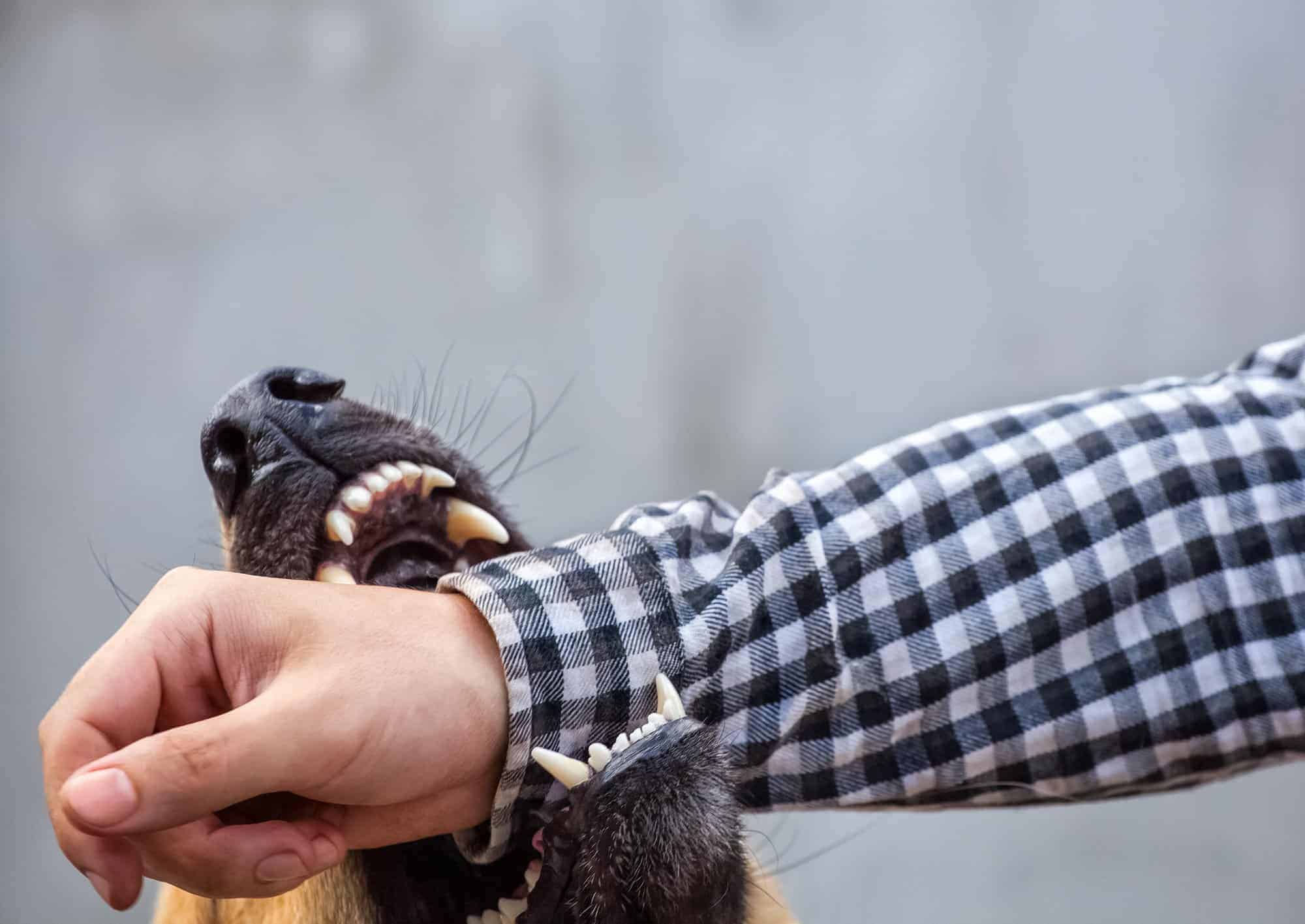 Male German Shepherd Dog Bites Man