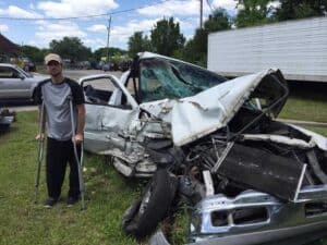 The most common injuries as a result of a crash while driving an automobile