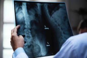 Temecula Back Injury Lawyer