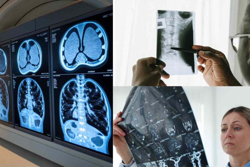 X-rays and brain scans being reviewed by medical professionals, showing how diagnostic imaging helps prove injuries after an Uber or Lyft accident in San Diego.